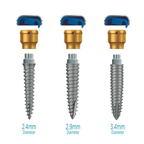 Zest dental - The All-In-One LOCATOR Overdenture Implant System is now compatible with LOCATOR R-TX ABUTMENTS offering 25% greater wear resistance, an impressive 60° of total implant divergence and dual retentive surfaces for easier seating of the overdenture. LOCATOR R-Tx delivers greater durability with easier maintenance.